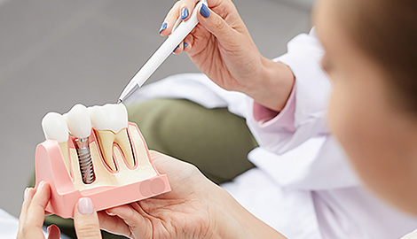 dental patient looking at a model of a dental implant